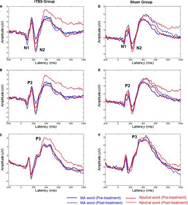 Modulation of Methamphetamine-Related Attention Bias by Intermittent Theta-Burst Stimulation on Left Dorsolateral Prefrontal Cortex